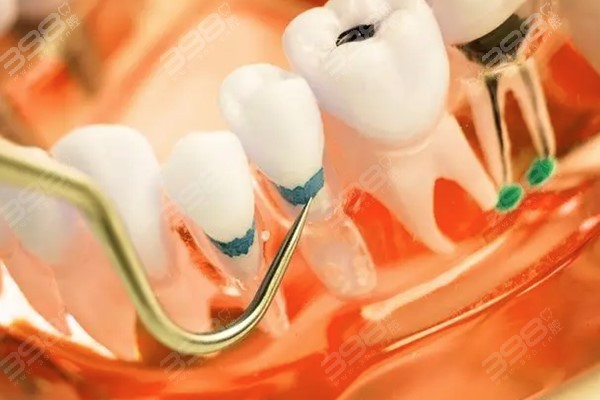 2023年牙冠价格解析,市场趋势与影响因素全面探讨